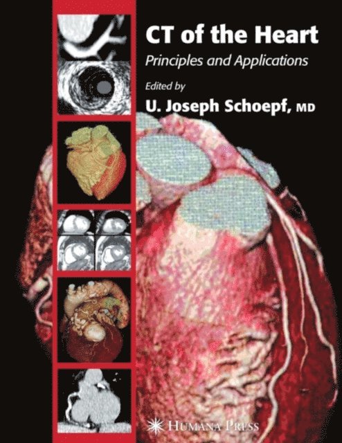 U. Joseph Schoepf - CT of the Heart, E-bok