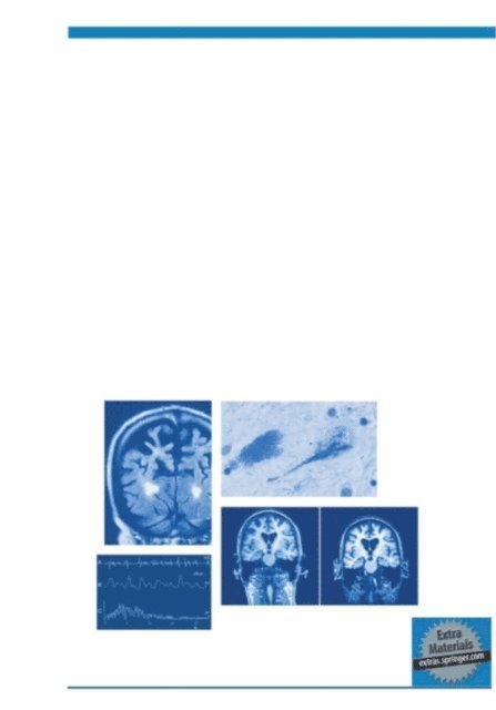 Irene Litvan - Atypical Parkinsonian Disorders, E-bok