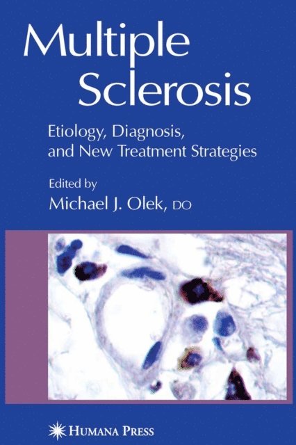 Michael Olek - Multiple Sclerosis, E-bok