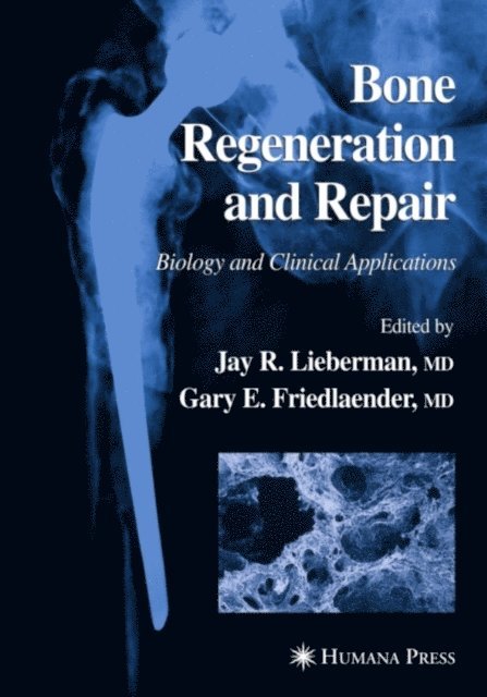 Gary E. Friedlaender, Jay R. Lieberman - Bone Regeneration and Repair, E-bok