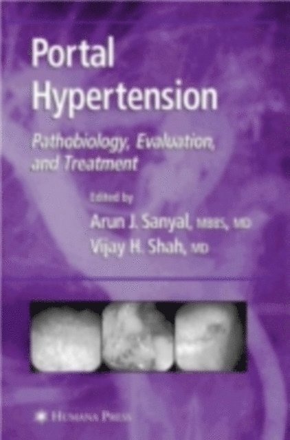 Vijay H. Shah, Arun J. Sanyal - Portal Hypertension, E-bok