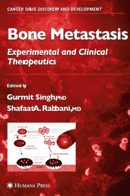 Shafaat A. Rabbani, Gurmit Singh - Bone Metastasis, E-bok