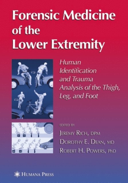 Robert H. Powers, Dorothy E. Dean, Jeremy Rich - Forensic Medicine of the Lower Extremity, E-bok