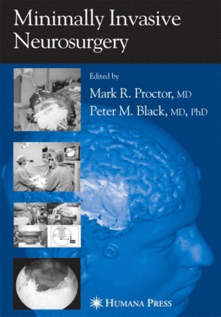 Mark R. Proctor - Minimally Invasive Neurosurgery, E-bok
