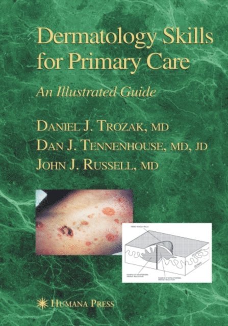 Dan J. Tennenhouse, Daniel J. Trozak - Dermatology Skills for Primary Care, E-bok