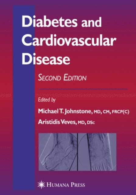 Aristidis Veves, Michael T. Johnstone - Diabetes and Cardiovascular Disease, E-bok