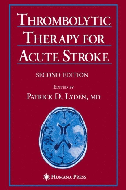 Patrick D. Lyden - Thrombolytic Therapy for Acute Stroke, E-bok