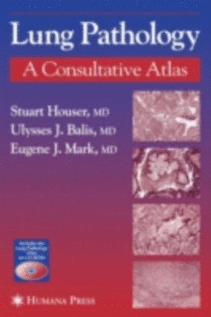 Ulysses J. Balis, Eugene J. Mark, Stuart Houser - Lung Pathology, E-bok