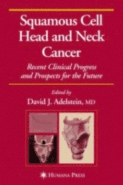 David J. Adelstein - Squamous Cell Head and Neck Cancer, E-bok