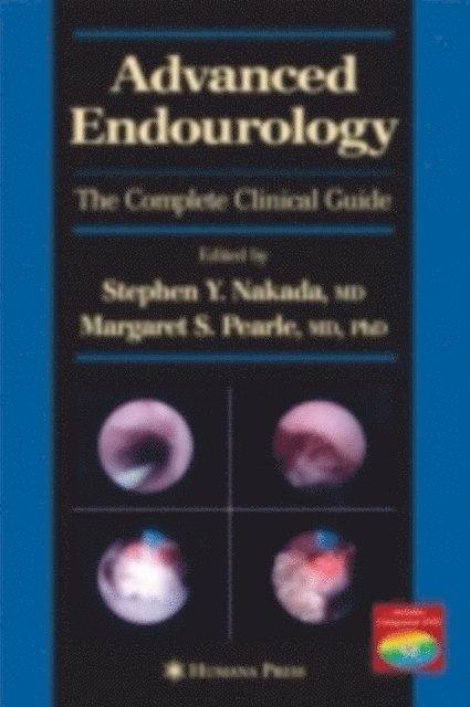 Margaret S. Pearle, Stephen Y. Nakada - Advanced Endourology, E-bok