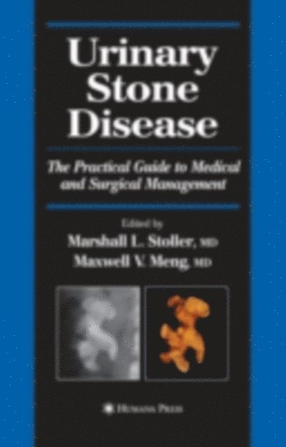Maxwell V. Meng, Marshall L. Stoller - Urinary Stone Disease, E-bok