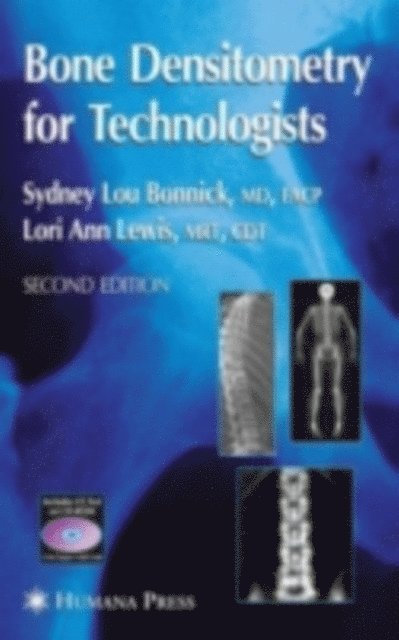 Sydney Lou Bonnick - Bone Densitometry for Technologists, E-bok