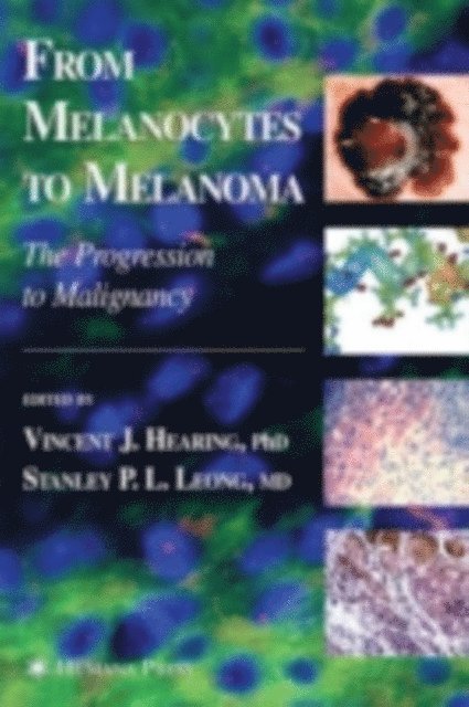 Stanley P. L. Leong, Vincent J. Hearing - From Melanocytes to Melanoma, E-bok