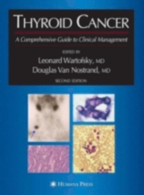 Douglas Van Nostrand, Leonard Wartofsky - Thyroid Cancer, E-bok