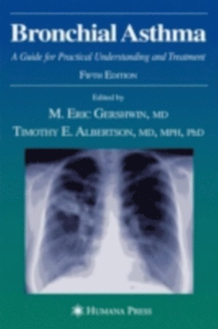 Timothy E. Albertson, M. Eric Gershwin - Bronchial Asthma, E-bok