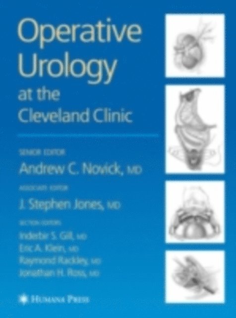 Jonathan H. Ross, Raymond Rackley, Eric A. Klein, Inderbir S. Gill, Andrew C. Novick - Operative Urology, E-bok