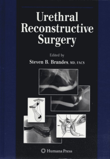 Steven B. Brandes - Urethral Reconstructive Surgery, E-bok