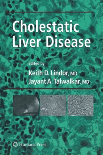 Jayant A. Talwalkar, Keith D. Lindor - Cholestatic Liver Disease, E-bok