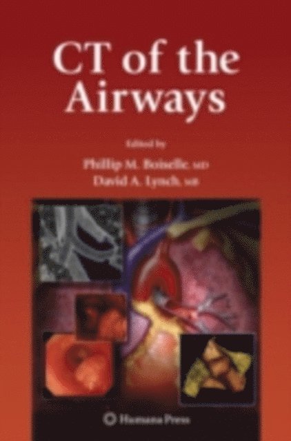 David Lynch, Phillip M. Boiselle - CT of the Airways, E-bok