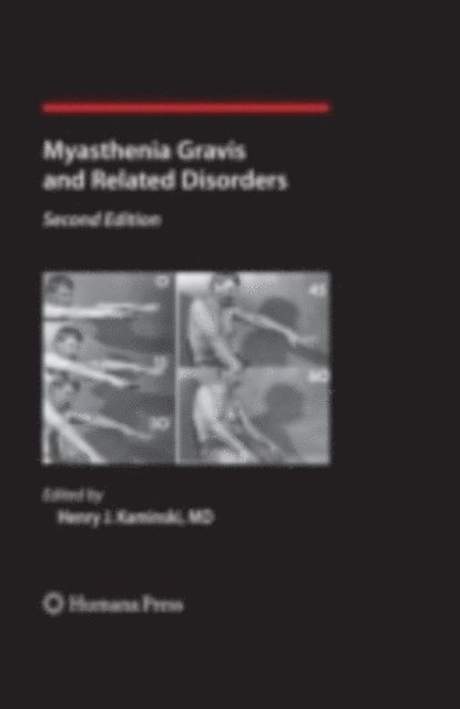 Henry J. Kaminski - Myasthenia Gravis and Related Disorders, E-bok