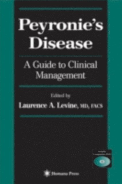 Laurence A. Levine - Peyronie's Disease, E-bok