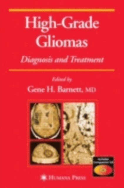 Gene H. Barnett - High-Grade Gliomas, E-bok