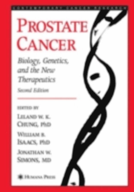 Jonathan W. Simons, William B. Isaacs, Leland W. K. Chung - Prostate Cancer, E-bok