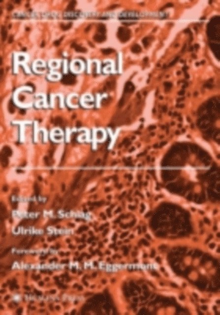 Ulrike S. Stein, Peter M. Schlag - Regional Cancer Therapy, E-bok