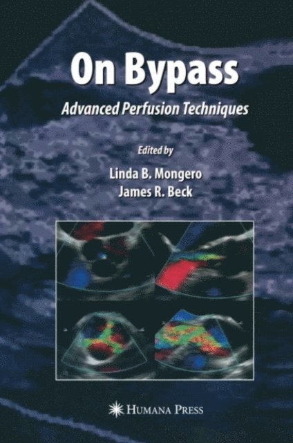 James R. Beck, Linda B. Mongero - On Bypass, E-bok