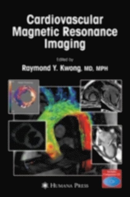 Raymond Y. Kwong - Cardiovascular Magnetic Resonance Imaging, E-bok