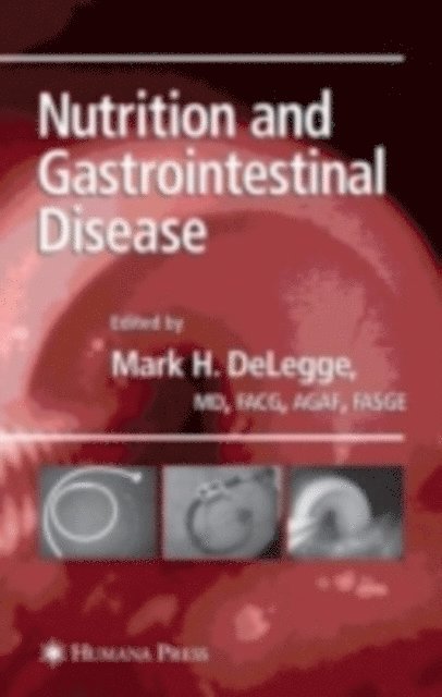 Mark DeLegge - Nutrition and Gastrointestinal Disease, E-bok