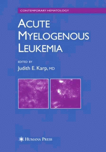 Judith E. Karp - Acute Myelogenous Leukemia, E-bok