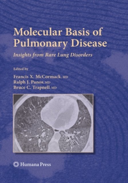 Bruce C. Trapnell, Ralph J. Panos, Francis X. McCormack - Molecular Basis of Pulmonary Disease, E-bok