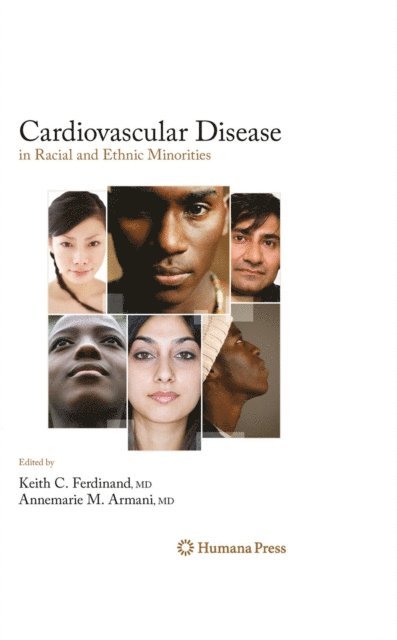 Annemarie Armani, Keith C. Ferdinand - Cardiovascular Disease in Racial and Ethnic Minorities, E-bok