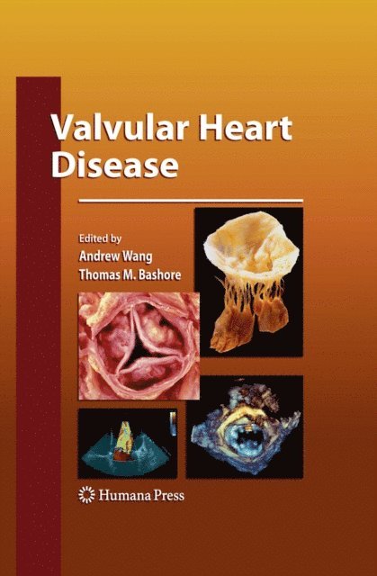 Thomas M. Bashore, Andrew Wang - Valvular Heart Disease, E-bok