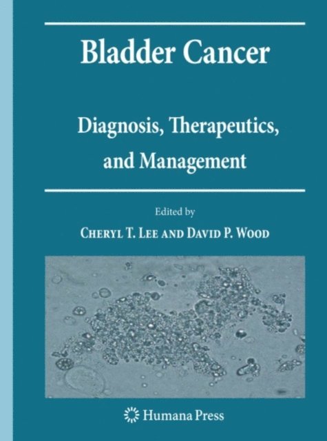 David P. Wood, Cheryl T. Lee - Bladder Cancer, E-bok