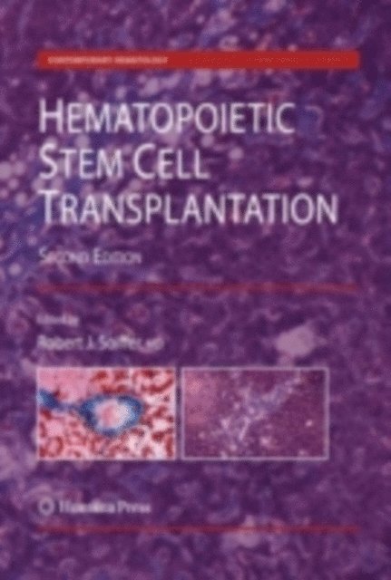Robert J. Soiffer - Hematopoietic Stem Cell Transplantation, E-bok