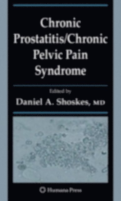 Daniel A. Shoskes - Chronic Prostatitis/Chronic Pelvic Pain Syndrome, E-bok