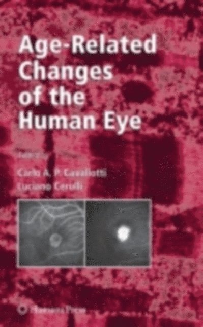 Luciano Cerulli, Carlo Cavallotti - Age-Related Changes of the Human Eye, E-bok