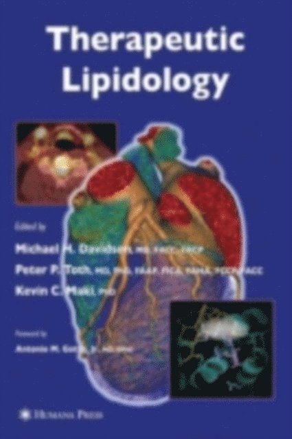 Kevin C Maki, Peter P. Toth, Michael Davidson - Therapeutic Lipidology, E-bok