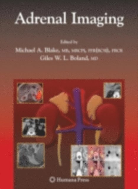 Giles Boland, Michael A. Blake - Adrenal Imaging, E-bok