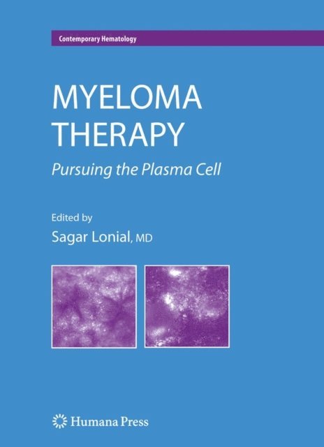 Sagar Lonial - Myeloma Therapy, E-bok