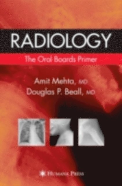 Douglas P. Beall, Amit Mehta - Radiology: The Oral Boards Primer, E-bok
