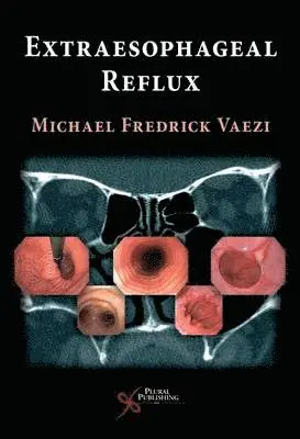 Michael F. Vaezi - Extra Esophageal Reflux, Inbunden. Tillgänglighet: Lägg i varukorg