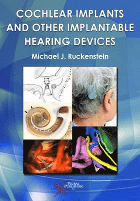 Michael J Ruckenstein - Cochlear Implants and Other Implantable Hearing Devices, Inbunden. Tillgänglighet: Tillfälligt slut
