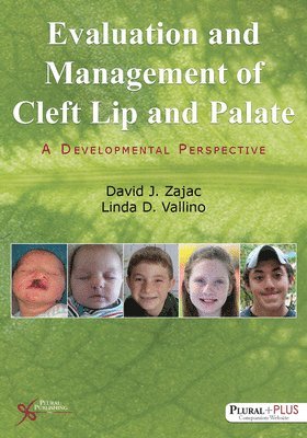 David J. Zajac, Linda D. Vallino - Evaluation and Management of Cleft Lip and Palate: A Developmental Perspective, Häftad