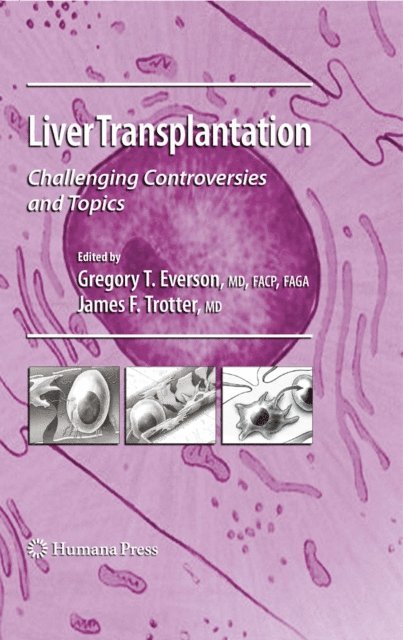 James F. Trotter, Gregory T. Everson - Liver Transplantation, E-bok