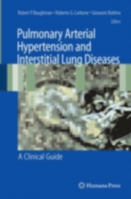 Giovanni Bottino, Roberto G. Carbone, Robert P. Baughman - Pulmonary Arterial Hypertension and Interstitial Lung Diseases, E-bok