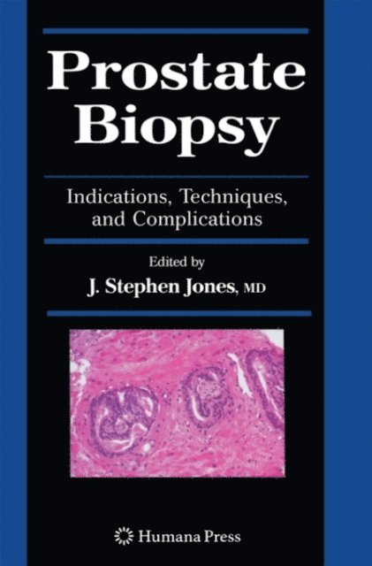 J. Stephen Jones - Prostate Biopsy, E-bok