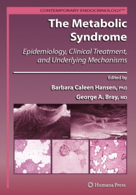 George A. Bray, Barbara C. Hansen - Metabolic Syndrome:, E-bok